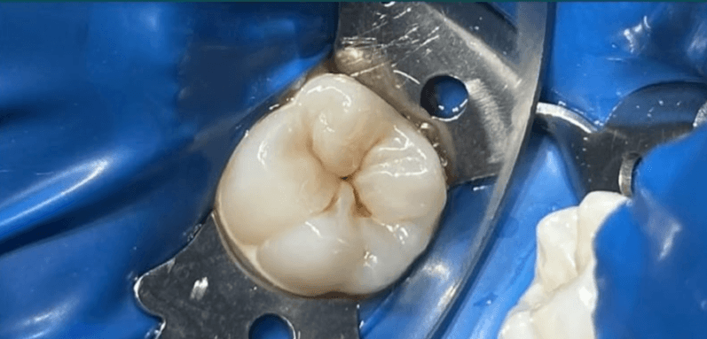 image (35) (1)